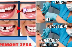 «Слепила, могу вытащить и заново поставить». На "Вайлдберриз" появились наборы "сам-себе-стоматолога"