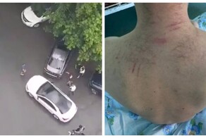 В Новосибирске парня исцарапала автоледи за то, что он ей не уступил дорогу