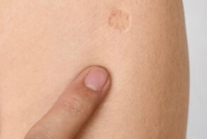 Кто в Российской империи первым рискнул привиться от оспы?