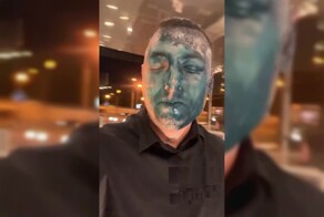 «Хорошо, не ножом и не кислотой»: фанатов «Балтики» облили зелёнкой в Москве
