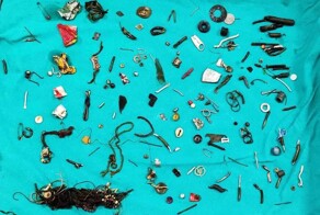 В&nbsp;Индии врачи извлекли из&nbsp;желудка 35-летнего мужчины 60 различных предметов
