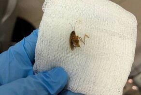 В Подмосковье из уха женщины достали живого таракана