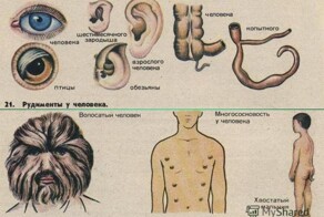 Какие органы у человека "лишние"