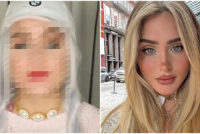 "Я была такой уродиной": жертва пластики потратила 30 000 долларов на операции