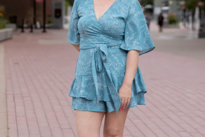 Девушку перекосило после инъекции ботокса