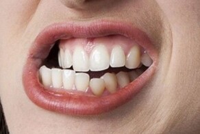 В Тюменской области дамочка укусила сотрудницу полиции, которая влезла ей в трусы