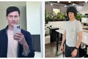 Биохакер стремится выглядеть и чувствовать себя на 18 лет