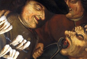 Что такое «зубы Ватерлоо», или Как битва 1815 года повлияла на развитие стоматологии