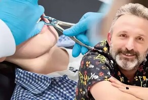 Турецкий уборщик выдал себя за стоматолога и удалил мужчине несколько зубов