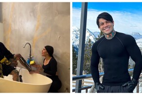 Блогер потратил 175 тыс. долларов на "самую болезненную" операцию по удлинению ног