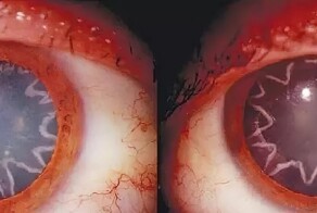 Электрик заполучил реальные звёздочки в глазах