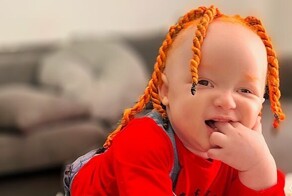 У чернокожих родителей получился ребёнок-альбинос с рыжими волосами