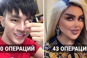 Эти люди прошли через рекордное количество операций, чтобы получить внешность своей мечты
