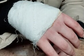 В Свердловской области у педагога сдали нервы и она истыкала руку школьника циркулем