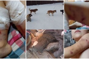 Стая собак напала на пятилетнего мальчика в Шелехове