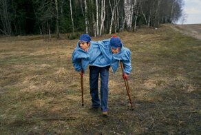 Что случилось с первыми сиамскими близнецами в СССР и как сложилась их судьба