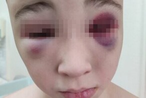 «За невыполнение приказов бил палкой по голове»: в Новосибирске мать отдала проблемного сына на перевоспитание в военно-спортивный центр и пришла в ужас от результатов