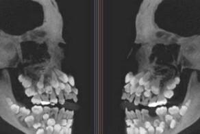 Аномалии человеческого тела, от которых становится жутко