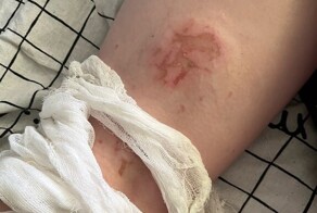 Щёлковского "кислотного маньяка" задержали