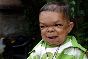 25-летний мужчина, которого мать до сих пор носит на руках