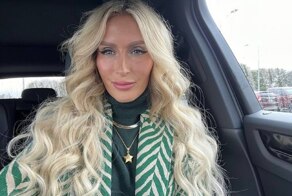 Зубные импланты сделали меня чудовищем: модель рассказала о своем ужасном опыте