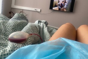В Брянске женщина умерла после подтяжки живота