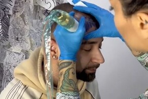 Лысеющий итальянец вытатуировал себе челку на лбу