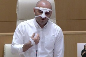 В грузинском парламенте вновь подрались из-за закона об иноагентах