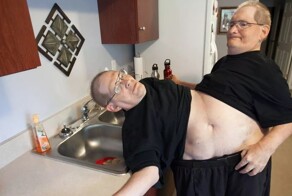 История сиамских близнецов-долгожителей Ронни и Донни Гэлион