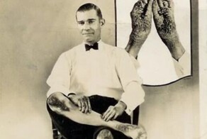 Ральф Крунер – человек со слоновьей кожей