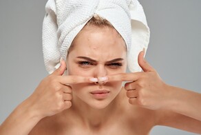 Привычка давить прыщи на подбородке и носу может привести к инсульту