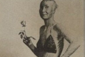 Удивительная Эстер и кожа, в которой она жила