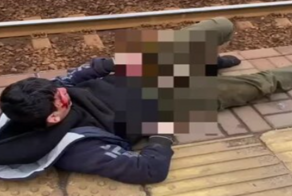 "Размножаться сможет": зацеперу, получившему удар током, врачи сохранили половой орган, но не руку