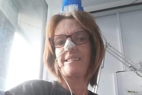 Женщина не дождалась врача и сама себе вырвала зуб плоскогубцами