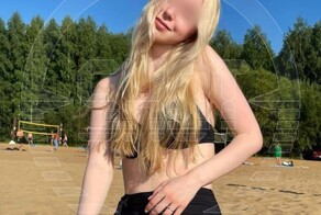 В Питере девушка попала в реанимацию с 80% ожогами тела после 5-часового пребывания на солнце