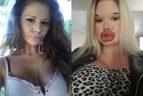 Девушки, которые ради "идеальной" красоты, превратили себя "страшных кукол" и чуть не сошли с ума