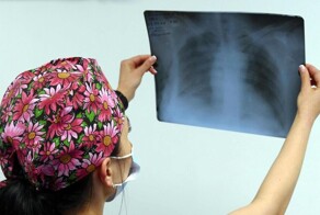 В Тыве воспитательница заразила туберкулёзом 9 детей