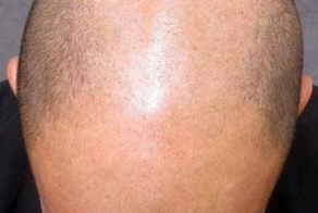 Татуировка для лысых (9 фото)