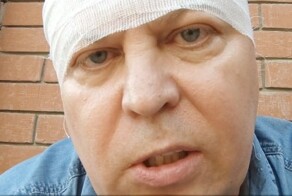 «Законодательство у нас настолько беззубое»: избитый депутат Матвеев прокомментировал задержание напавших на него мигрантов