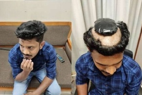 Индиец вёз килограмм золота в прямой кишке, но попался. Чем он выдал себя?