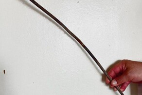 Подмосковные врачи спасли неудачно приземлившегося на железный прут дачника