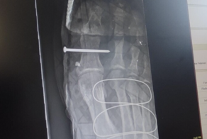 14 людей, которым однажды крупно не свезло