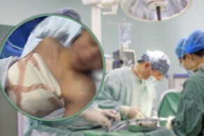19-летнего парня обманом заставили сделать операцию по увеличению груди