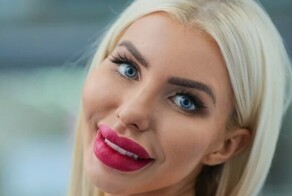 Виталий Милонов призвал россиянок, которые увеличили губы, одеваться скромнее