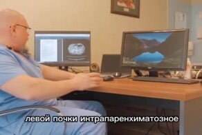 В Москве хирурги выполнили сложную операцию по удалению опухоли почки