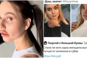 "Сделала свисток": в соцсетях обсуждают, красиво ли увеличивать губы