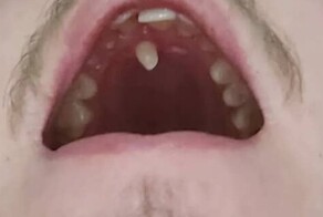 25 удивительных и страшных аномалий человеческого тела