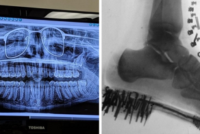 15 случаев, когда рентгеновские снимки показывали, что интересного можно увидеть внутри привычных вещей