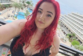 Девушка 20 лет питалась только картофелем из-за редкой фобии