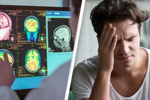 Страдаете от головных болей? Невролог объяснил, как отличить опухоль мозга